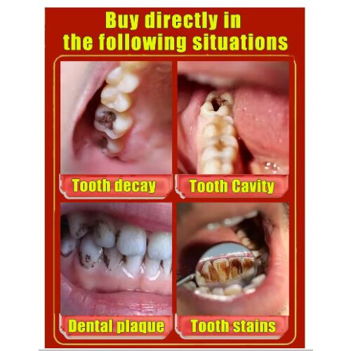 Tooth decay killer, see the change in just 7 days 1