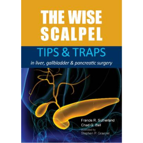The Wise Scalpel