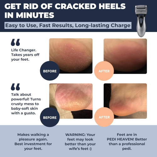 Own Harmony Electric Callus Remover, 3 Rollers, USB Rechargeable 1
