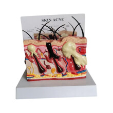(As show, One size) Skin Acne Model, Human Anatomy Normal Common Acne Skin, Physiology Education, Doctor Anatomy Model-C10