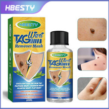 Germ Warts, Hand And Foot Warts, Corns, Herbal Essence, Facial Wart Removal Solution 30ml