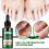 Ginger Nail Care Solution Hand And Foot Grey Nail Cleansing Treatment Solution 4