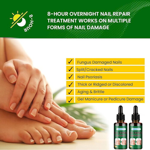 Ginger Nail Care Solution Hand And Foot Grey Nail Cleansing Treatment Solution 2