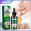 Ginger Nail Care Solution Hand And Foot Grey Nail Cleansing Treatment Solution 1