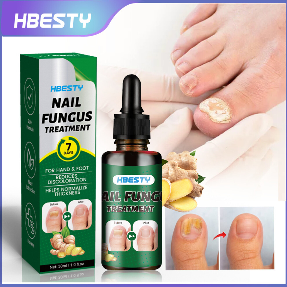 Yetp Star Grey Ginger Nail Care Solution Hand And Foot Nail Cleansing Treatment Solution