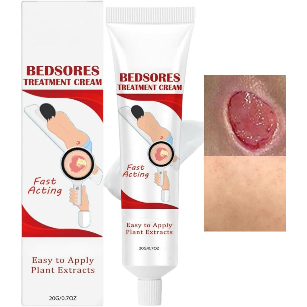 Gogerstar Bed Sore ,Bedsore Wound Care ,Pressure Sore For Wound Care,Bed Sore Wound Treatment ,Pressure Sore Relief Cream