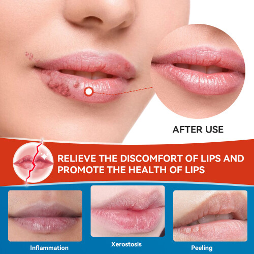 Cheritis Cream Lippenpflege Hautcreme 1