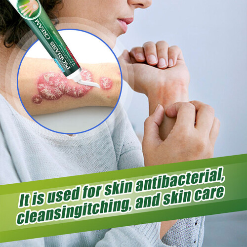 Hautringwurmcreme Psoriasis externe Haut 2
