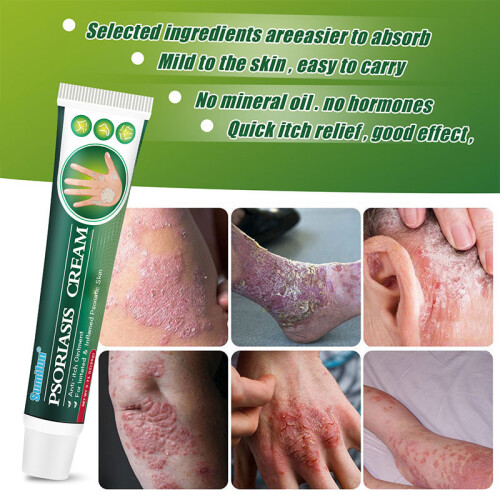Hautringwurmcreme Psoriasis externe Haut 1