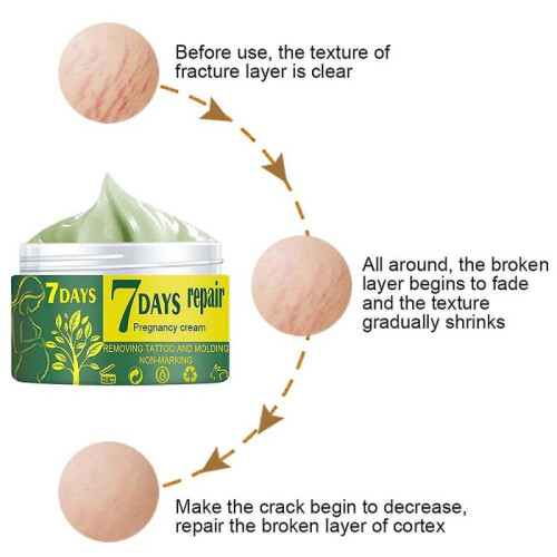 (30g)Pregnancy- Stretch Mark Removal, Repair Body Cream 2