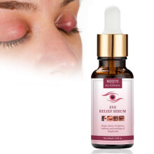 Chalazion Eye Treatment For Blepharitis 30ml Moisturize Eyelids Serum og Chalazion Remover Gentle Under Eye Relief Serum For Dark Circles Eye Pos