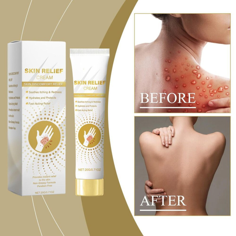 Skin Soothing Cream Quickly Eczema Symptoms Reduce Itching And Redness And Make Skin Comfortable Again.