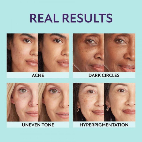 (Rich) Supreme Complexion Perfector, long-lasting, waterproof, transfer-resistant, perfect foundation 1
