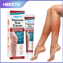 Venenreparaturcreme Bein Meridian Venen diastolische Pflegecreme Bein antipyretisches Gel