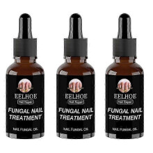 (03 30ml)3Pcs Nail Fungus Treatment Nail Cream Nail Antifungal