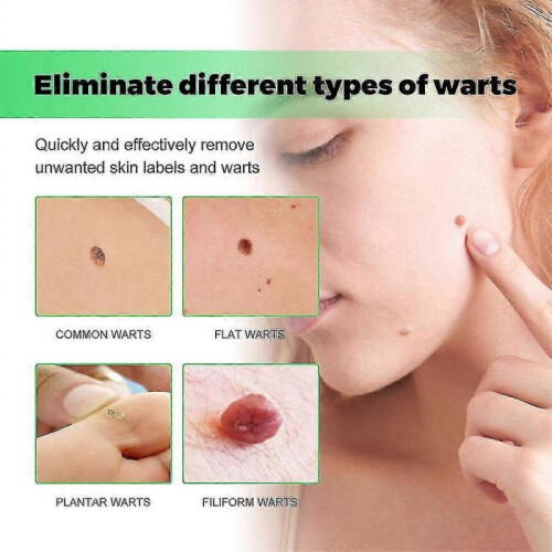 Skin Wart Eliminator Soaps - XSS 1