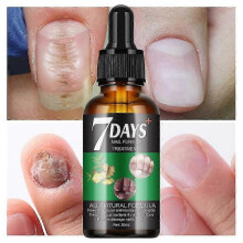 (1pcs)7 Days Nail Fungus Treatment, 7 Days Nail Growth and Strengthening Serum Nail, Nail Repair Solution, Restoring Healthy Nails