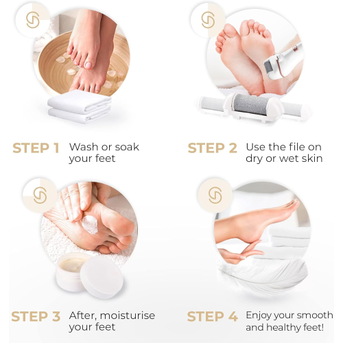 Essy Electric Foot File Hard Skin Remover with 5 Replacement Rollers 2