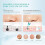 Blackhead Remover Pore Vacuum 2