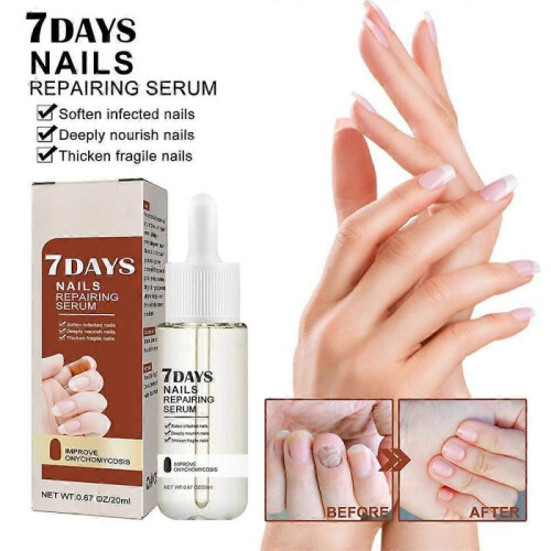 New Nail Growth And Strengthening Serum Fast Dispatch 2024 1
