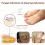South Moon Nail Fungus Light Therapy Device 3