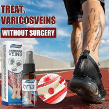 (3pcs)Varicose Vein Massage Spray for South Moon