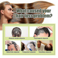 South Moon Dense Hair Oil Hair Care Antihair Loss Repair Hair Tail Dry And Manic Hair Soft And Moisturizing Dense Hair Oil