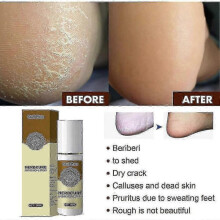 3pcs Antibacterial Foot Spray South Moon, Anti Itch, Sweat Odor Control, Exfoliating, Men Women, Antifungal Shoe