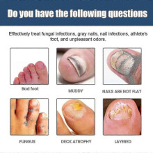 South moon onychomycosis repair spray moisturizes and cleans odor onychomycosis soft nail dry nail care