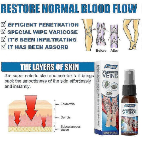 (3pcs)Varicose Vein Massage Spray for South Moon 2