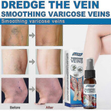 (4pcs)Varicose Vein Massage Spray for South Moon