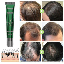South Moon Antihair fall care solution strengthens hair, prevents breakage, roots, ginger, hair care, damage repair