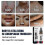 South Moon Vitiligo Treatment Spray 2
