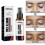 South Moon Vitiligo Treatment Spray 1