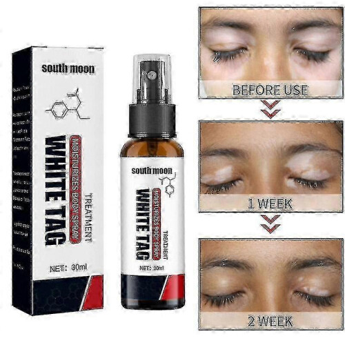 South Moon Vitiligo Treatment Spray