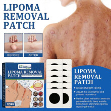 South Moon Fat Knot Repair Patch Soothes Various Fat Knots in the Body, Dissolves Subcutaneous Lumps, and Care Patch