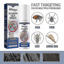 South Moon Head Lice Removal Spray Hair Removes Lice And Fleas Removes Lice Eggs And Pubic Lice  | 3725979145633