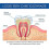(1pcs) SOUTH MOON Gingival Fixation Toothpaste Curing Teeth Soothing Gingival Pain 2