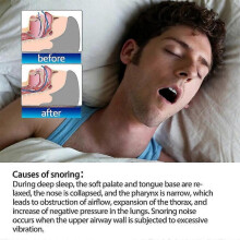 South Moon 100PCS Nasal Strips Easy Breathing Sleep Stop Snoring Relief Pressure