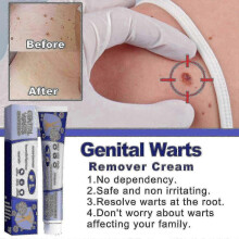 South Moon Wart Cream Repairs and Cleanses Skin Normal Wart Cream Body Face Wart Cream BF  | 7351446467500