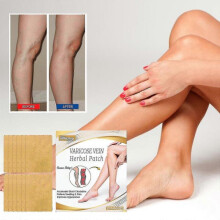 South Moon Vein Care Patch Vein Massage Relieve Leg Soreness and Swelling Earthworm Leg Care Patch