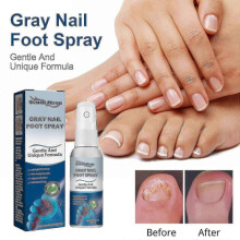 South moon onychomycosis repair spray moisturizes and cleans odor onychomycosis soft nail dry nail care