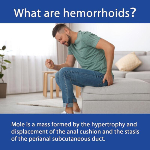 South Moon Broken Hemorrhoid Cream 2