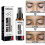 South Moon Vitiligo Treatment Spray 1