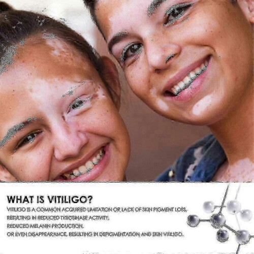 South Moon Vitiligo Treatment Spray 2