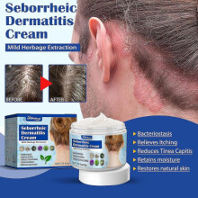 South Moon Seborrheic Skin Cream Skin Cream Scalp Ringworm Head Acne Itchy Skin Problems Repair