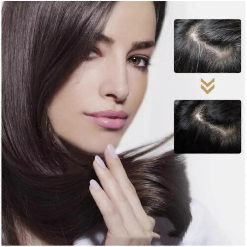 (Polygonatum odoratum) Polygonum Multiflorum Shampoo Soap Effectively Reduce Dandruff and HairBreakage 2
