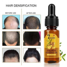 2pcs Hair Growth Essence Natural Beauty Hair Growth Fluid Ginger Hair Growth Essence Oil
