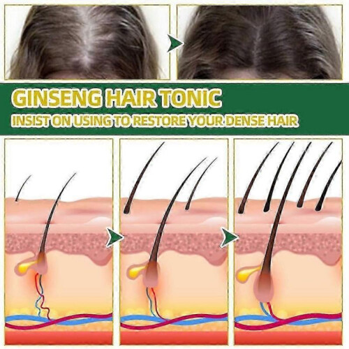 Ouhoe Ginseng Hair Tonic 100ml 2