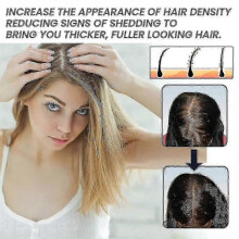 3pcs Ouhoe Hair Serum Biotin Hair Generating Essential Oil Repair Damaged Hair Anti loss Fast Regrowth 3618518977539
